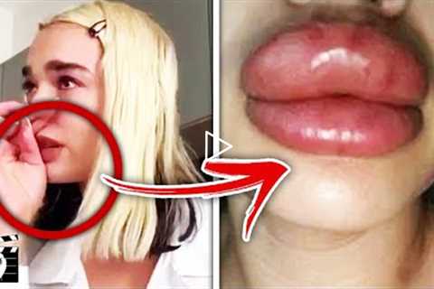 Top 10 Celebrities Who Went WAY Too Far With Plastic Surgery