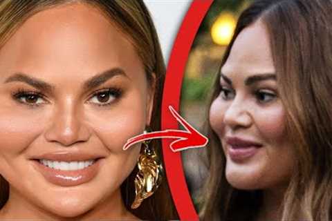 Top 10 Plastic Surgery Disasters That Celebrities Tried To Hide