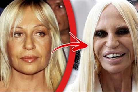 Top 10 Celebrities Who Instantly Regretted Their Plastic Surgery